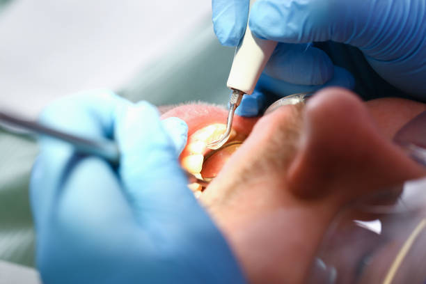 Best Emergency Dental Care for Trauma or Injury in Warren, IL