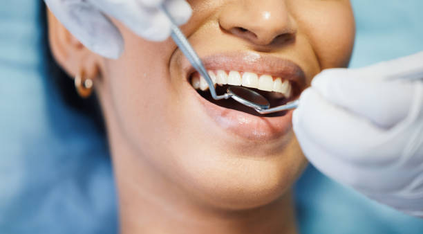 Best Emergency Root Canal Treatment in Warren, IL